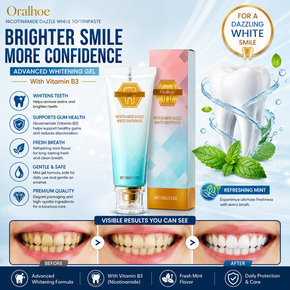 Nicotinamide Dazzle White Toothpaste – Advanced Whitening Gel with Vitamin B3 | Fresh Mint | 100g